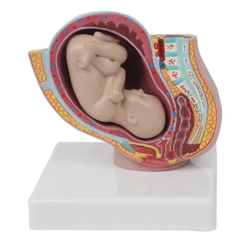 Объяснение преподавания в медицинской школе: малый таз беременности с моделью младенца; Женский таз с доношенной моделью плода